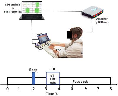 BCI-activated electrical stimulation in children with perinatal stroke and hemiparesis: A pilot study